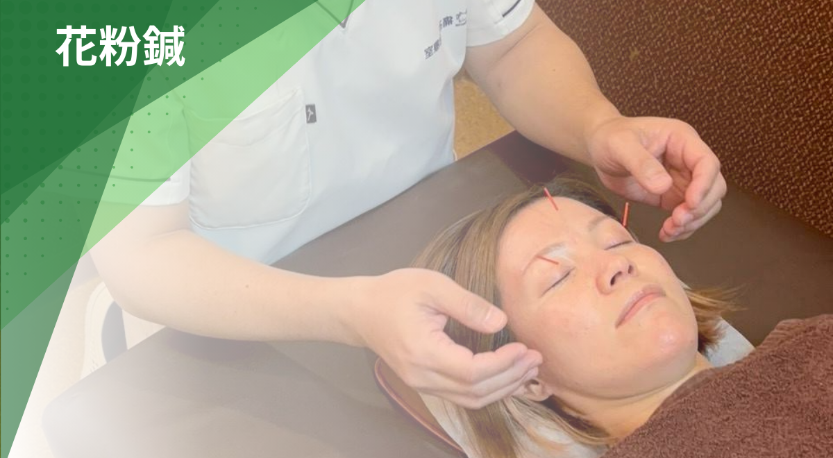 八王子市・日野市で花粉症に対して行う鍼施術（花粉鍼）の様子